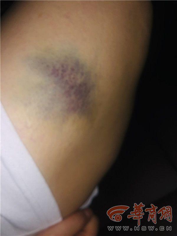 西安当街被打女子发声：我不是拜金女，此前被威胁不敢报警