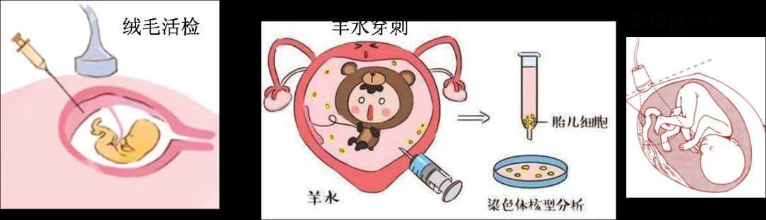 新闻频道 陕西 5,有不明原因自然流产史,畸胎史,死胎或死产史的孕妇