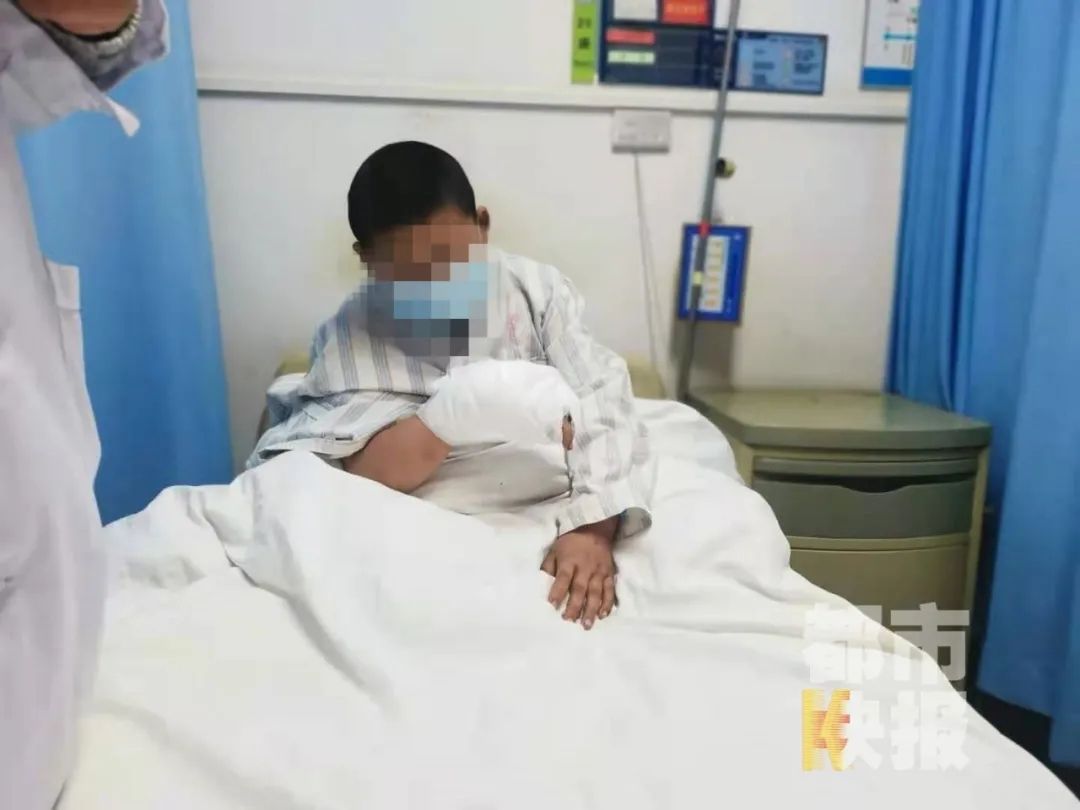 商洛11岁男孩放炮不慎被炸成重伤 手指成"骨架"险截肢