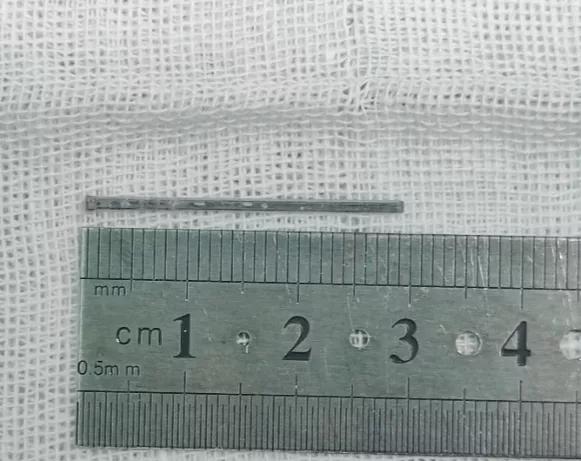 险30毫米铁钉扎入工人眼睛快医生18分钟手术保住眼球