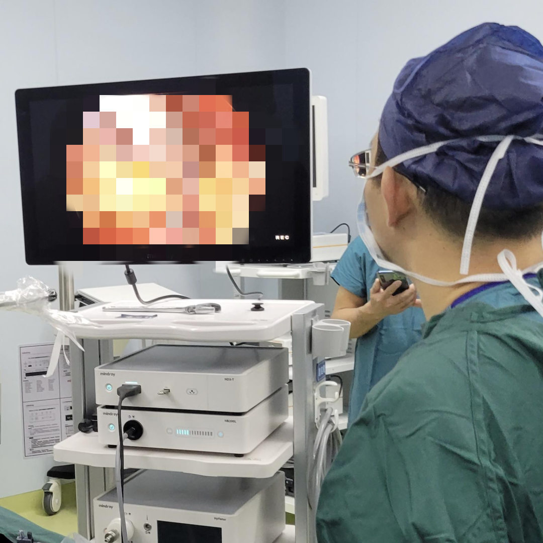 我院开展单孔腹腔镜下阑尾切除术-汉滨区第三人民医院