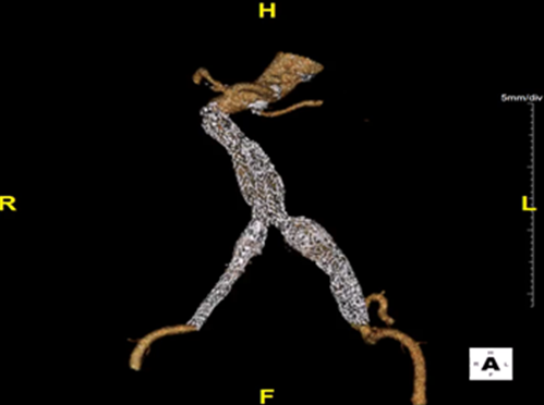 ee2654f673e075e4bd12fcec28a686f6.png