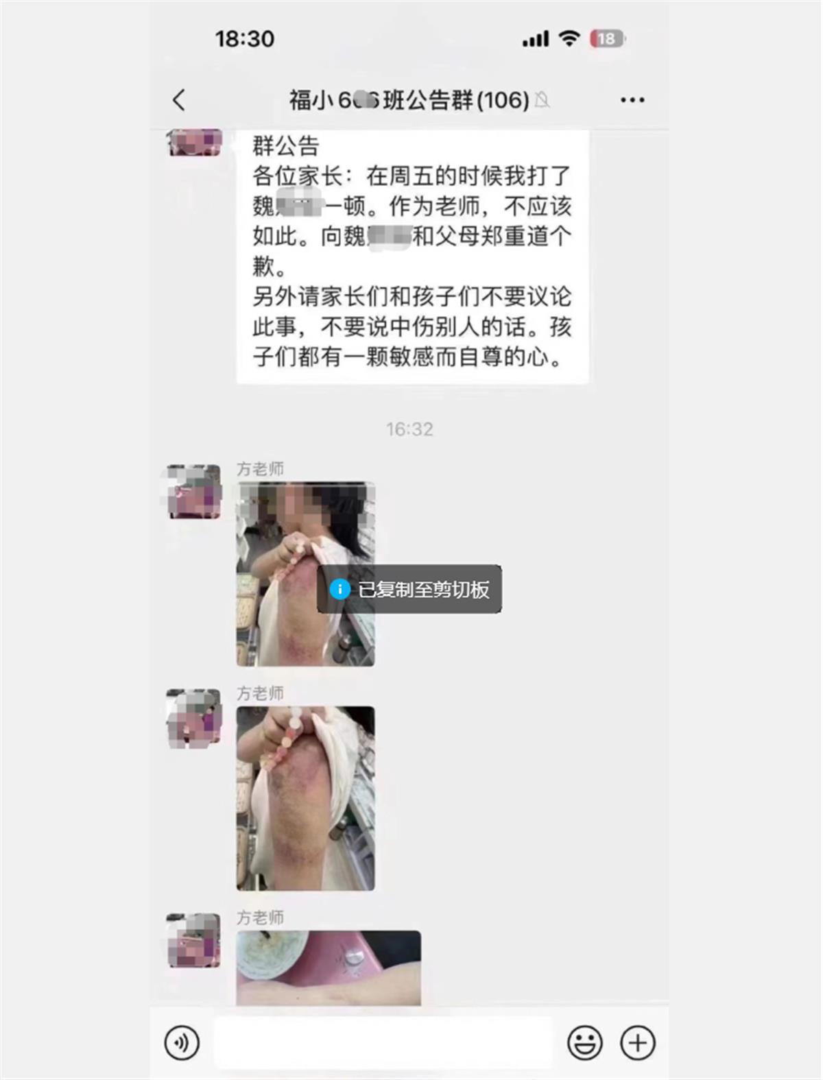 da5fd7a2caa70c10a977e2be3fcd7cbf.jpeg