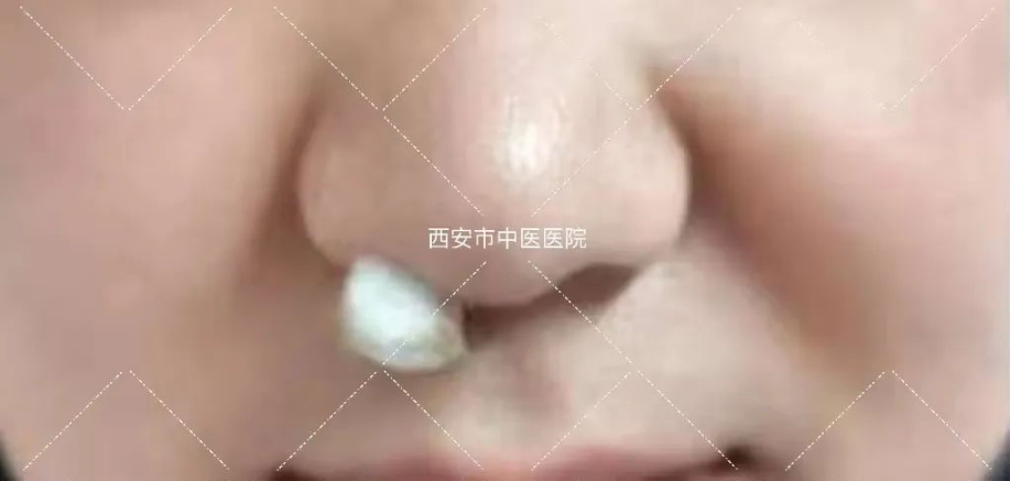 408dfb11aa461fd19e6b5f3580b5afa7.png