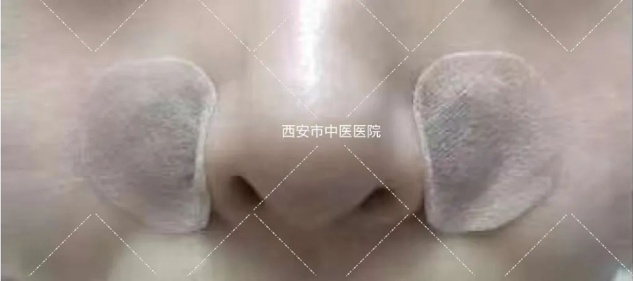 28271743c956a3a4d797ee3c3108cde4.png