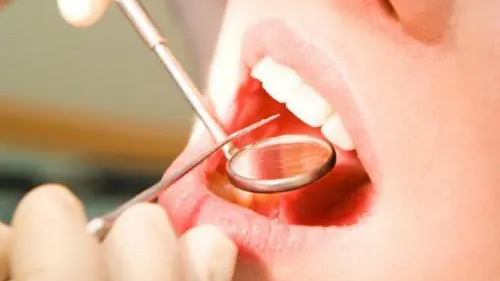 7月起西安市民看牙能报销了 牙髓活力检查等27项治疗可医保支付