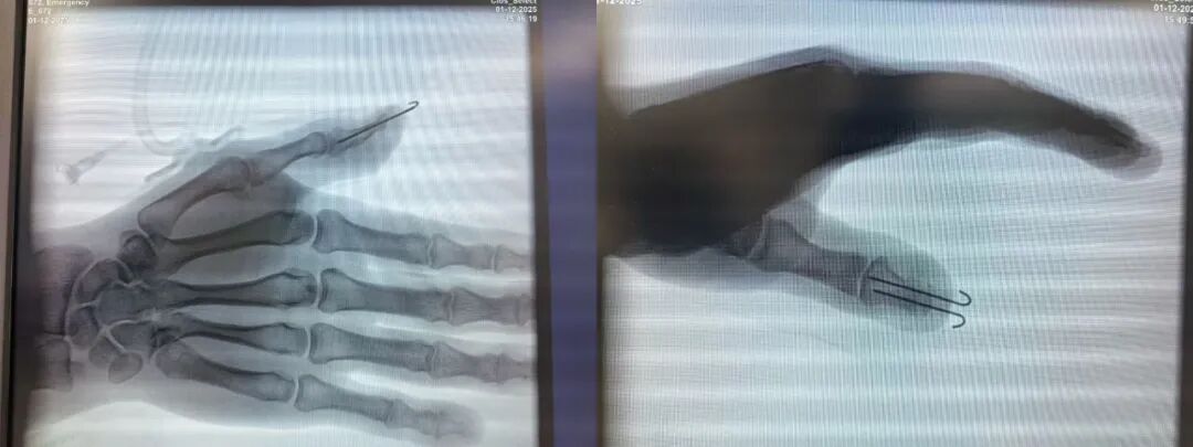 正在上传... 6c54f1d8ba6852cf1029e07ba140f440.jpg