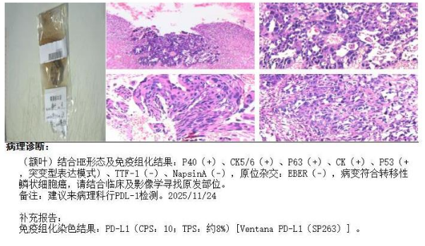 正在上传... 12139063834fe1dbb5b68b405d7ac0d4.png