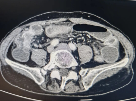 正在上传... 584700b38c3b951c4ce32c6043844b53.png