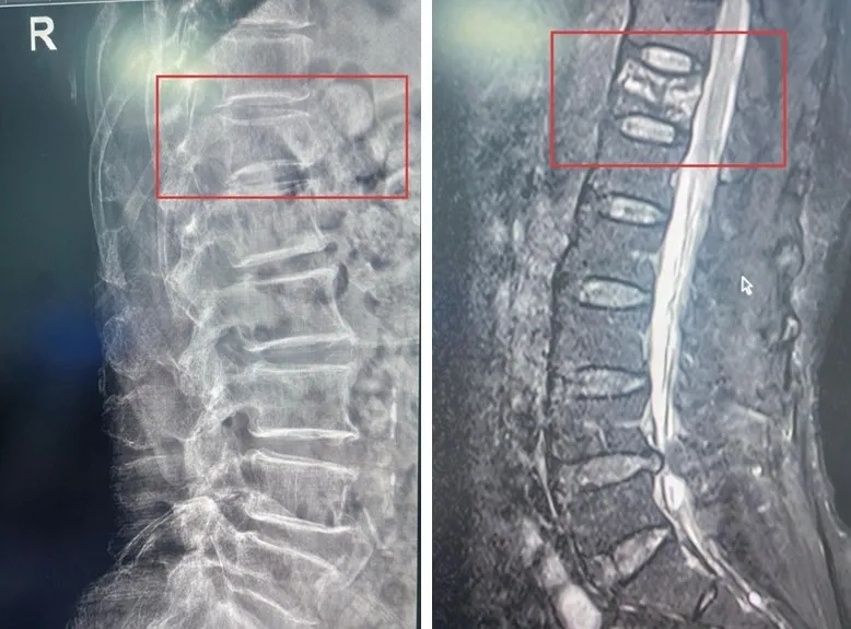 正在上传... 6b5fda7fa11639c382f774fb57c141e1.png