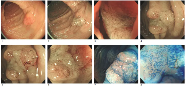 正在上传... 36aa85a94f86de580c8b6d29639db63b.png