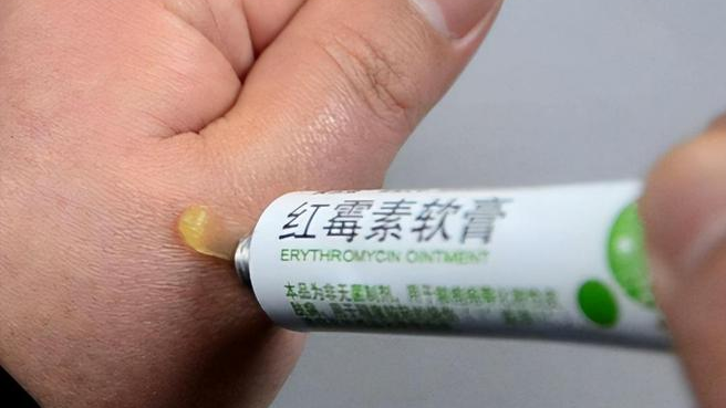 红霉素软膏千万不能随便用！赶紧告诉家里人