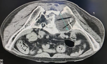 正在上传... 60a218ba3bfcfcc50ec5326f2fae91d7.png