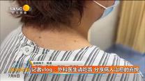 记者vlog：外科医生请吃饭 分享病人治愈的喜悦