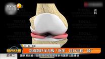 跳绳跳坏半月板？医生：且行且珍“膝”
