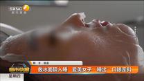敷冰面膜入睡   爱美女子“睡出”口眼歪斜