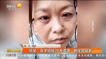 惊呆！女子短短20天遭遇“断崖式衰老”