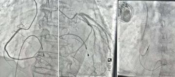 生命接力 守护心跳——西安市中心医院成功救治高陵区心脏骤停危重患者