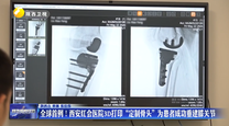 全球首例！西安红会医院3D打印“定制骨头”为患者成功重建膝关节