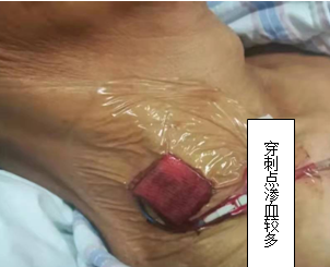 疫情下西安市第三医院护理门诊不停歇