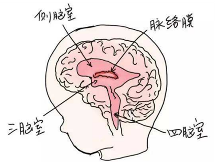 超声科普孕期超声发现胎儿脉络丛囊肿怎么办