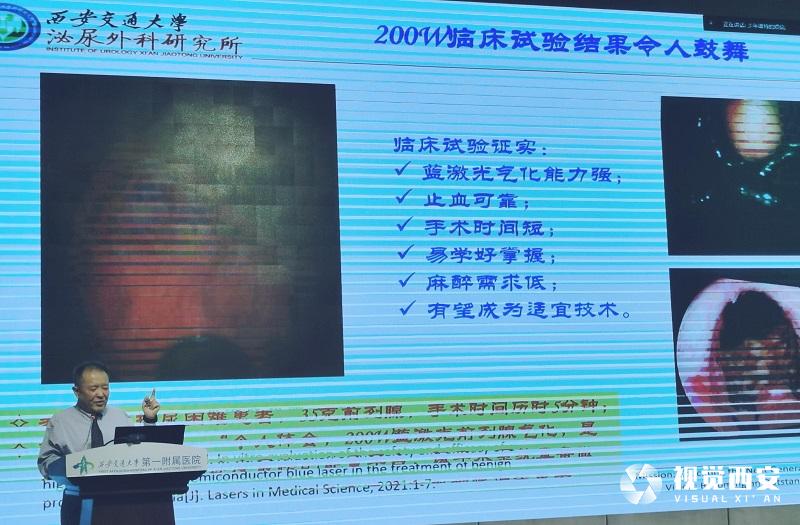 世界首创200w蓝激光手术设备成功应用于临床