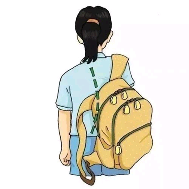孩子双肩一高一低是脊柱侧弯早期症状