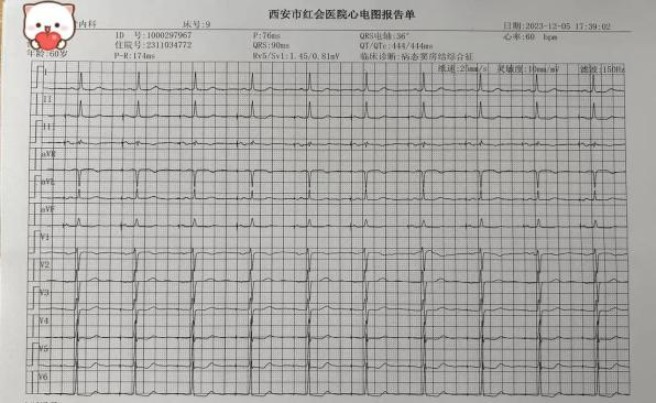 重获心生西安市红会医院心血管内科完成北院区首例希浦系统起搏器植入